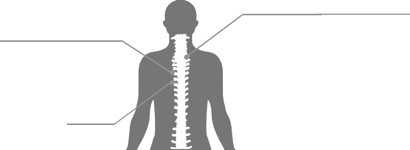 Vertebral Fracture | Neurosurgery | Marina del Rey Hospital